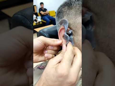 ازاله شعر الاذن بالشمع 💈✂️😂 #fun #funny #fyp #viralvideo #foryou #comedy #funnyvideo