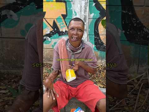 BORONG TISU PAK DEFI YANG BERJUALAN DENGAN KONDISI LUKA BAKAR