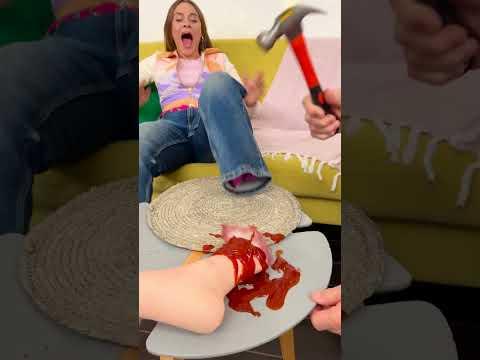 Bunicul și „Piciorul Rupt” - O Farsă Demnă de Oscar! 😂🦵