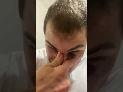 Tadalafellas colocando o próprio nariz no lugar