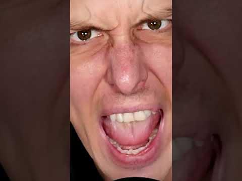 My Friend Is Addicted To...?💊Google Feudle