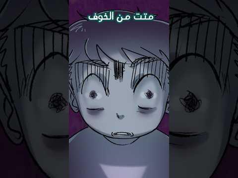 كانوا راح يقطعوا رجلي 😨 ✂️