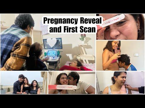 Pregnancy Reveal | First and Third Scan | Diya Krishna