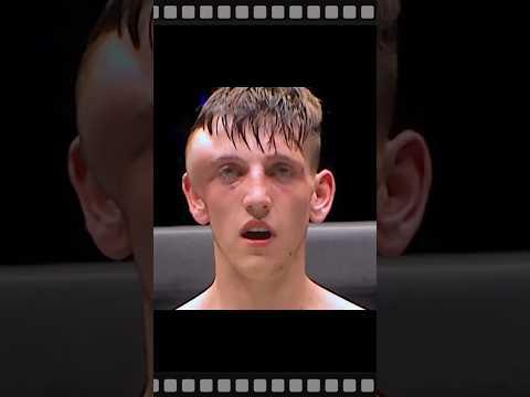 What happened to this fighter?