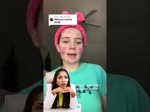 Trio Blemish tagged for mild/ moderate acne in Skin of Colour for acne, red & brown marks #acne