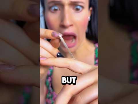Why you Shouldn’t Peel Hangnail😱