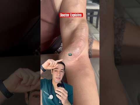 Why THIS is a sign of kidney failure