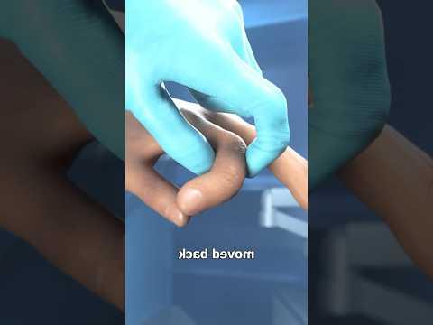 നമ്മുടെ ശരീരത്തിലെ എല്ല് പൊട്ടിപ്പോയിട്ടുണ്ടെങ്കിൽ അതിനെ പഴയത് പോലെ അക്കി നോക്കിയാലോ 🤯😱 | Bone ☠️