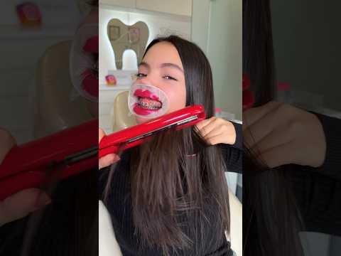 ESTO SALIO MAL!!! 😢😭🔥 @seleneguzmanh #odonto #dentista #divertido #humor #chistoso #gracioso