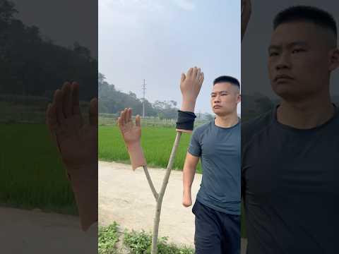 Lost hand 馃槀馃ぃ